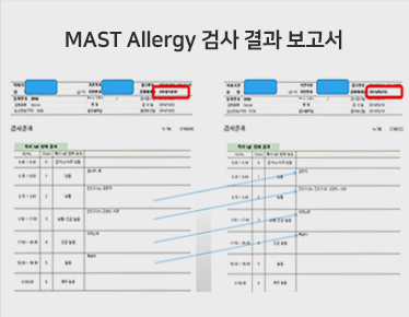 앤 한의원의 알레르기 치료법